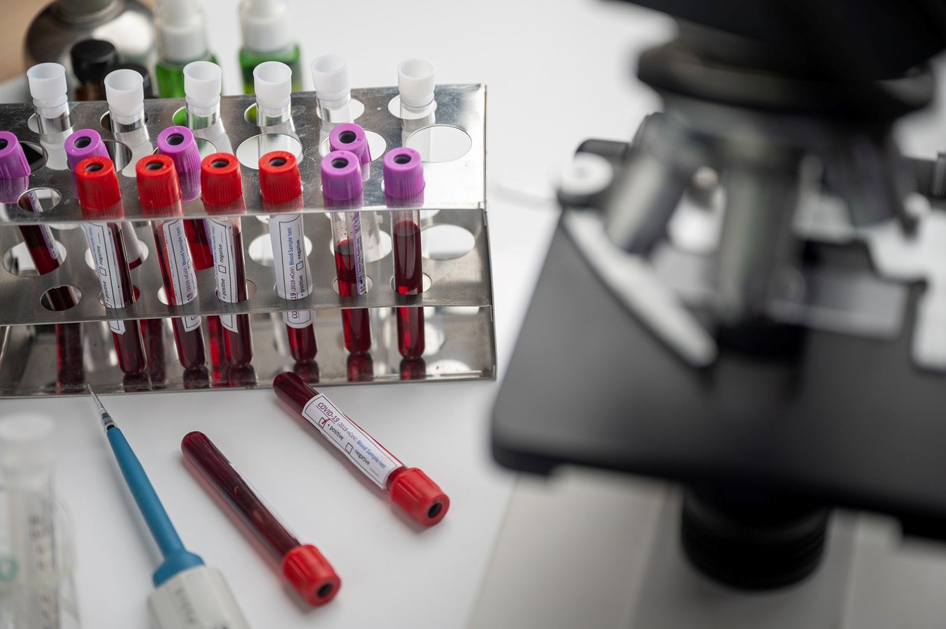 Santé Canada autorise un premier test de dépistage sérologique, annonce Ottawa