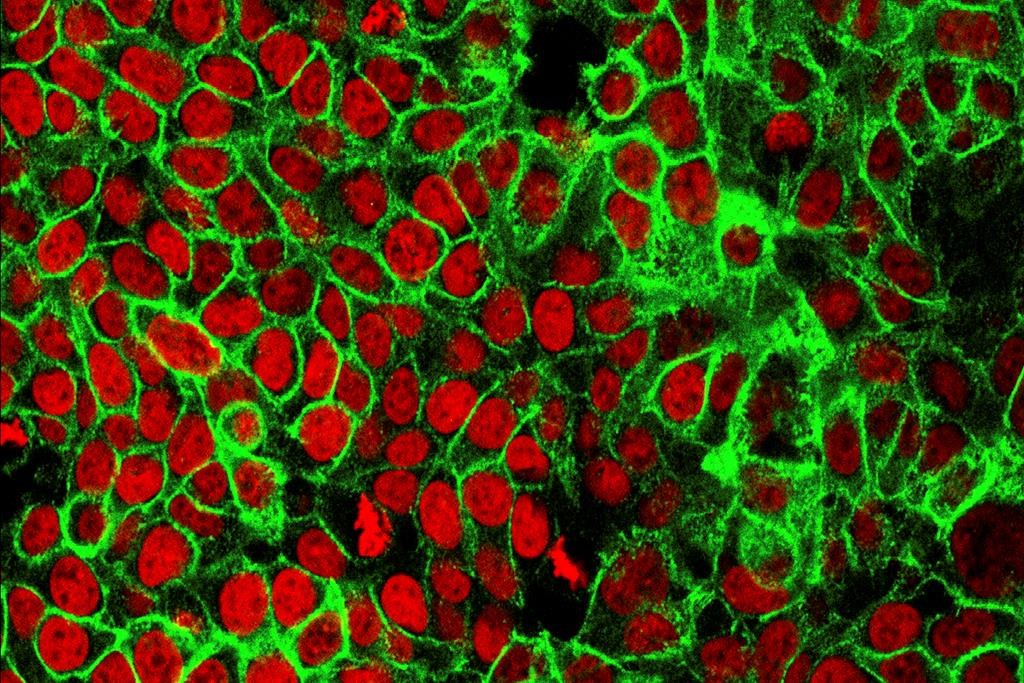 Cancer colorectal: une molécule contre la dépendance à la cocaïne offre un espoir