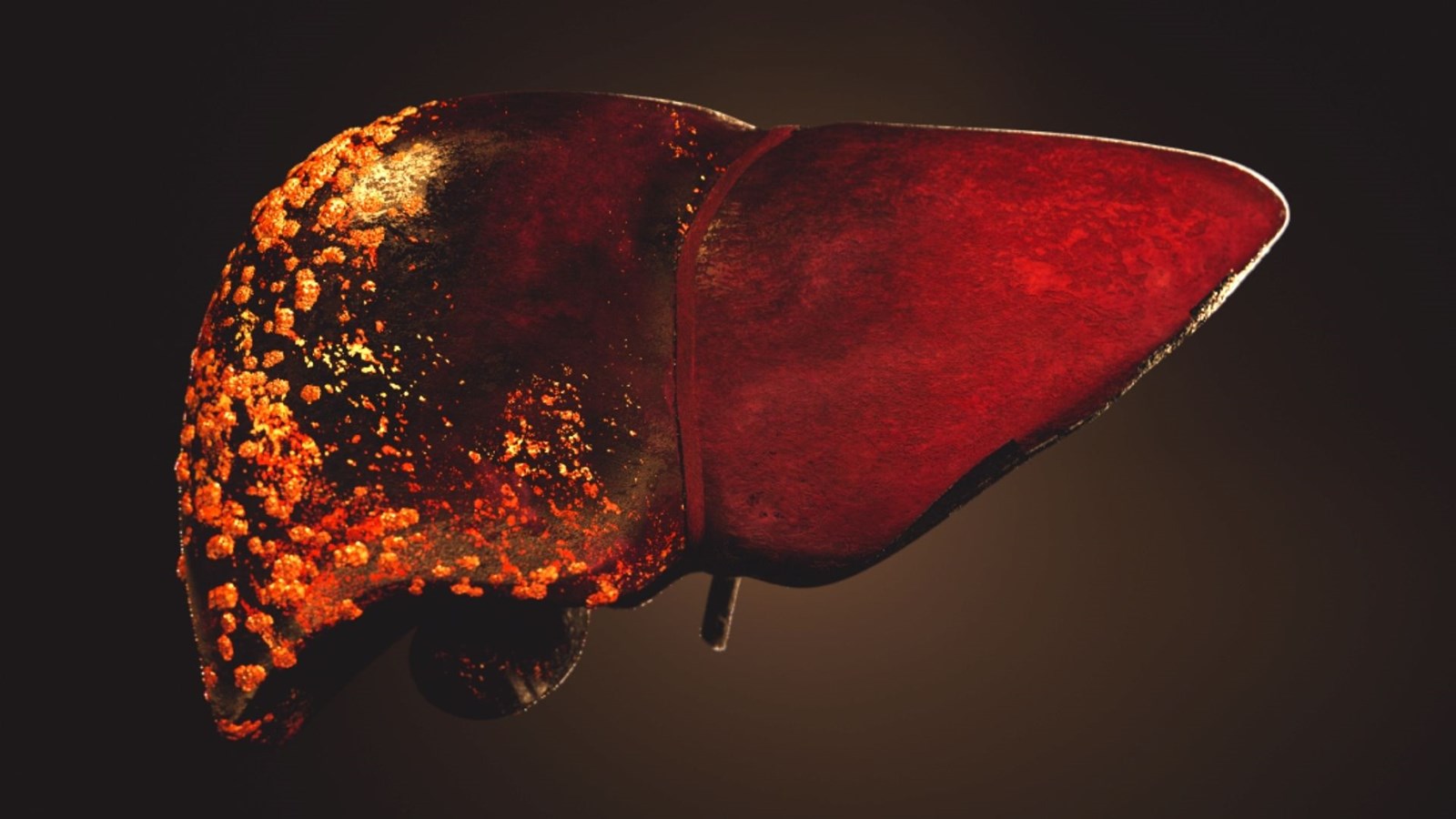 Le tabac cause 5 types de cancer digestifs