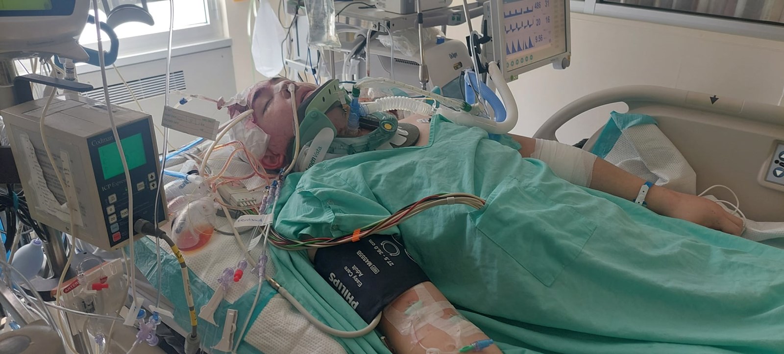 Mordre dans la vie à pleine dent après un grave accident de voiture