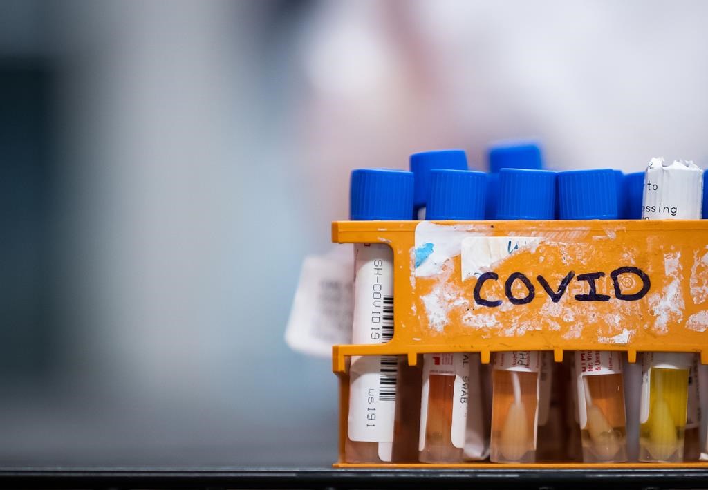 La Nouvelle-Écosse signale 215 réinfections à la COVID-19 depuis la vague Omicron